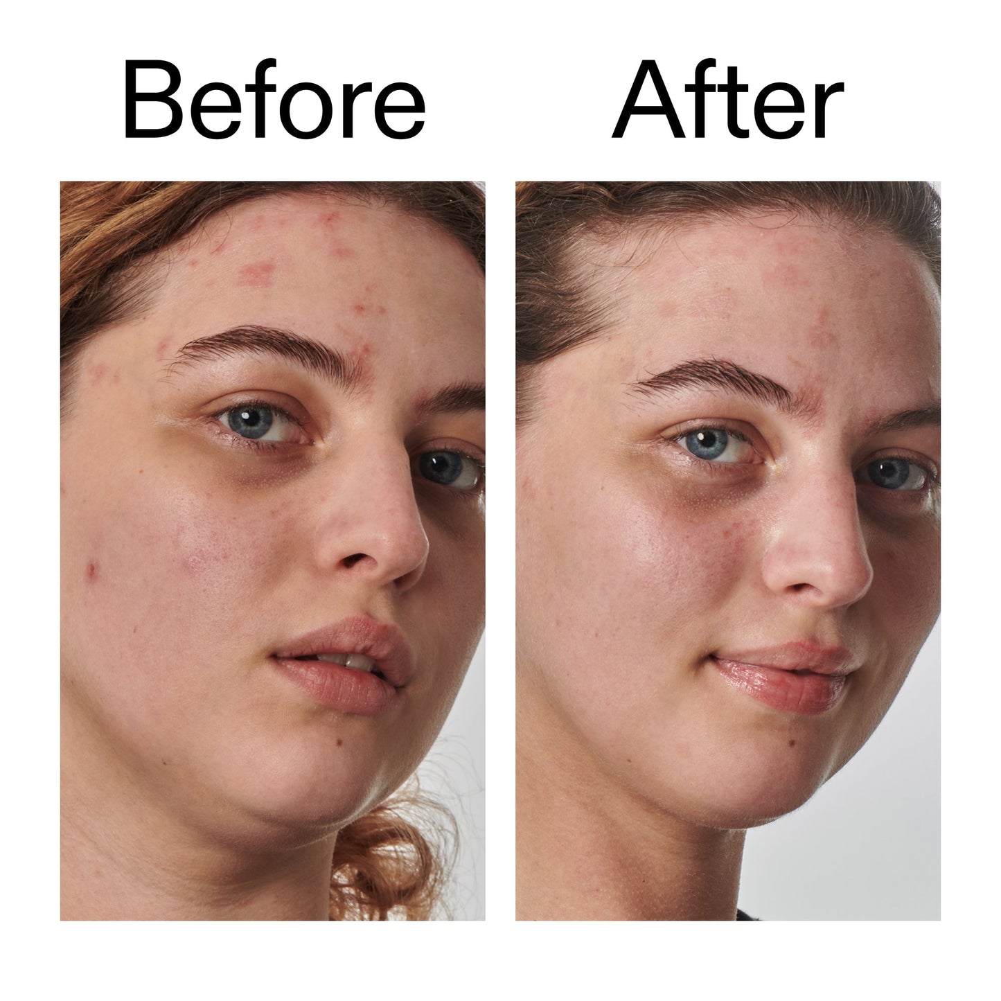 10-urea-moisturizer-q3 Dry_and_Rough_Skin_Solution_Before_After_2000x2000_efa6e639-5c39-49bd-a5dd-f0220293120a.jpg
