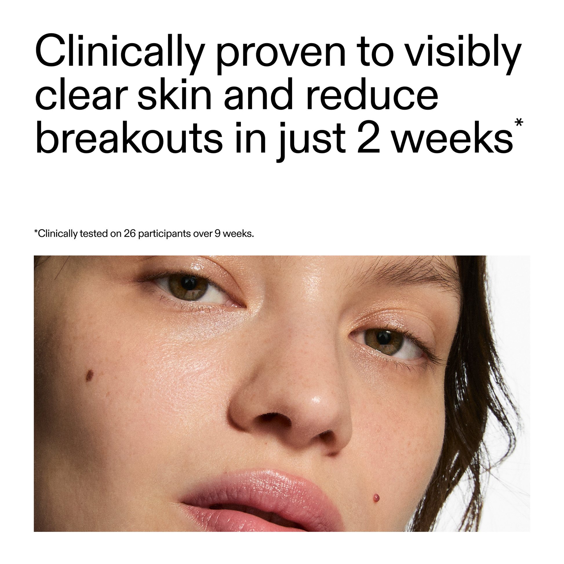 360-acne-clearing-serum-q4 360_Serum_Key_Claim.png