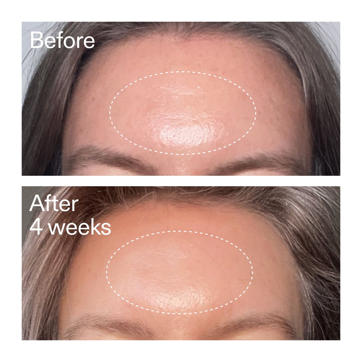 advanced-0-2-retinal-serum-r2 AdvancedRetinal_BeforeAfter1_2000x2000_1da6bb0a-29dd-41d1-95b7-8679696bbf0f.jpg