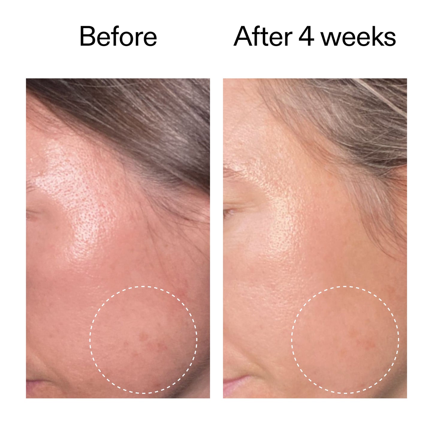advanced-0-2-retinal-serum-r2 AdvancedRetinal_BeforeAfter2__2000x2000_62fb16bb-77ae-4d63-8500-88dbf847f4b9.jpg