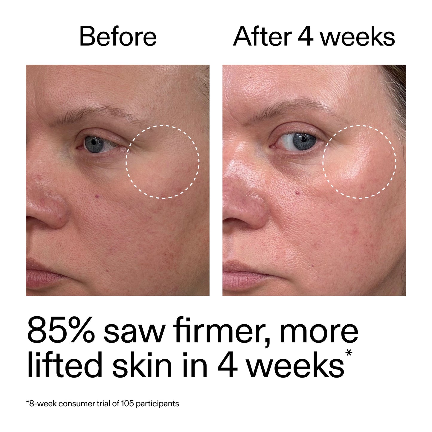 advanced-0-2-retinal-serum-r2 AdvancedRetinal_BeforeAfter_Claim1_2000x2000_bcc385c4-5e73-4f1e-aba8-64267937d0d3.jpg
