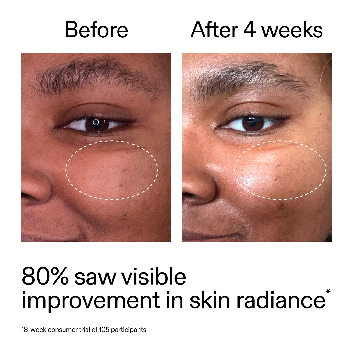 advanced-0-2-retinal-serum-r2 AdvancedRetinal_BeforeAfter_Claim2_2000x2000_39d11e3d-eda9-44ec-ab32-2903b1a368bd.jpg