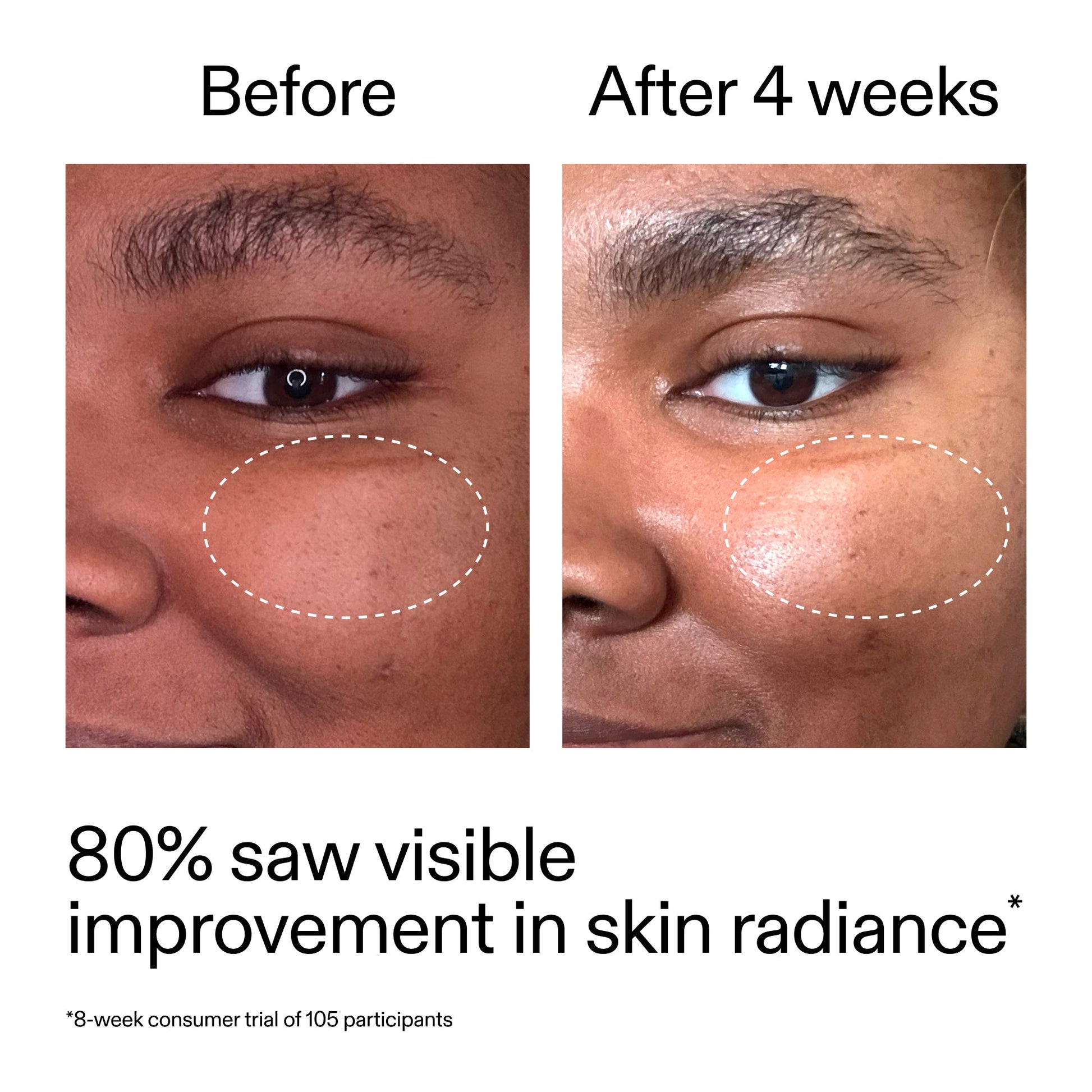 advanced-0-2-retinal-serum-r2 AdvancedRetinal_BeforeAfter_Claim2_2000x2000_39d11e3d-eda9-44ec-ab32-2903b1a368bd.jpg