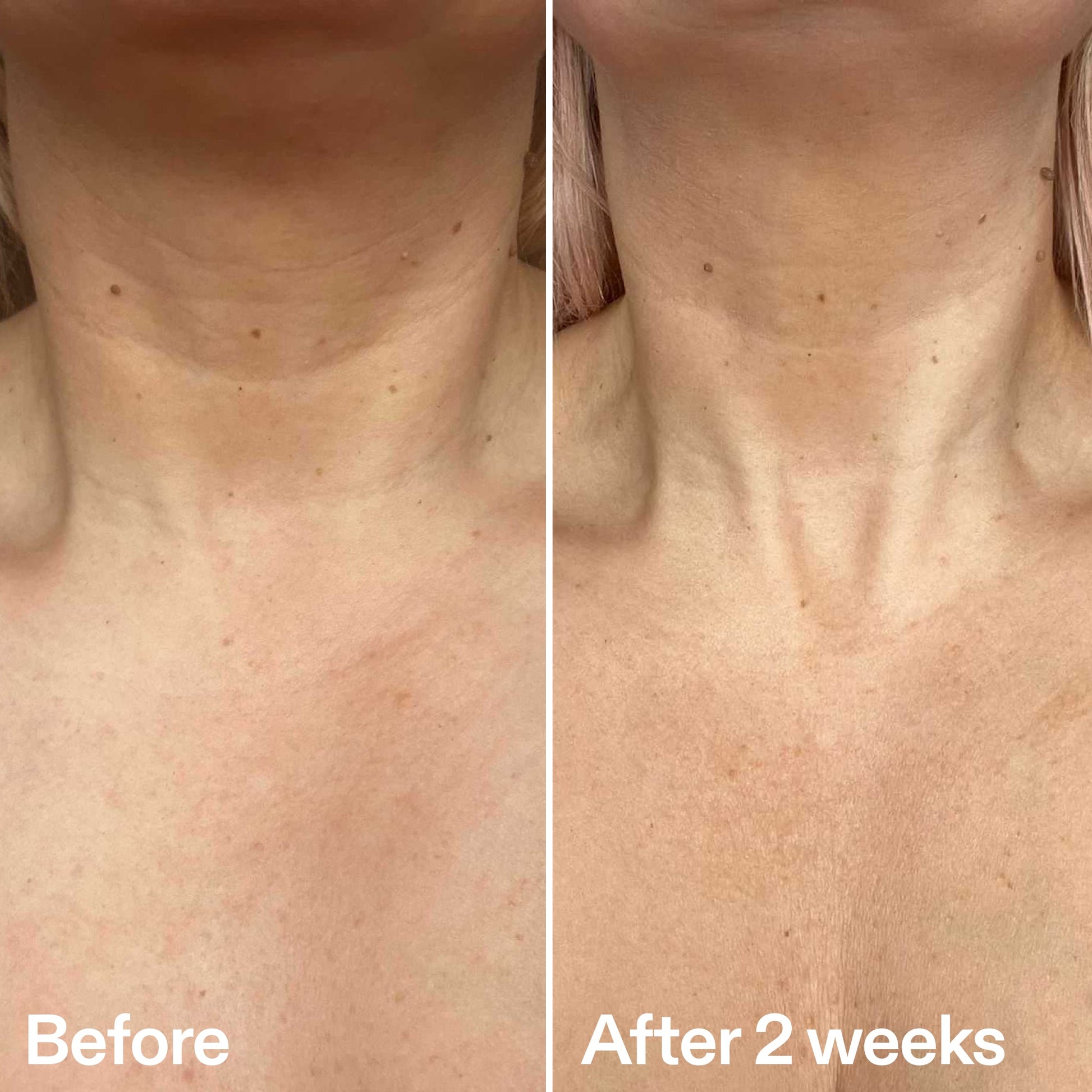 bio-active-neck-lift-stick-k3 B_A_2.jpg