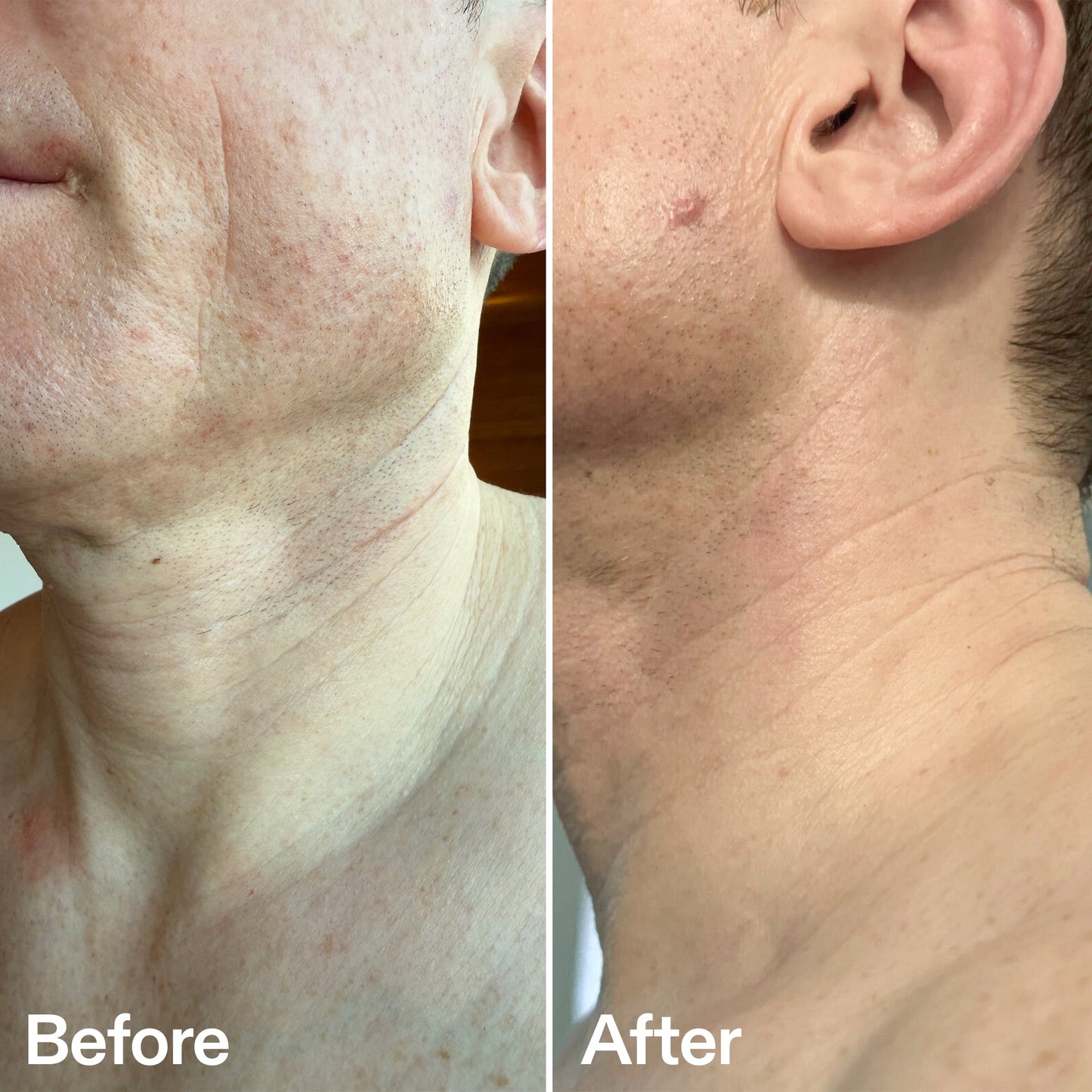 bio-active-neck-lift-stick-k3 B_A_afa2743e-b8e2-4504-92f4-e281cb6cf759.jpg