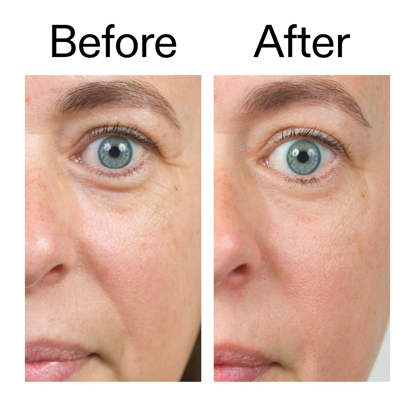 bio-active-ceramide-moisturizer-w0 Bio-Active_Before_After_2000x2000_566e5a9e-135e-417a-8242-b44e5fa35463.jpg
