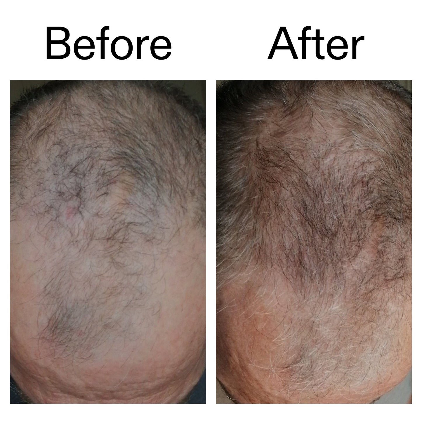 3-month-hair-growth-trio-u2 Caffeine_Scalp_Treatment_B_A_Ppage_2000_x_2000.jpg
