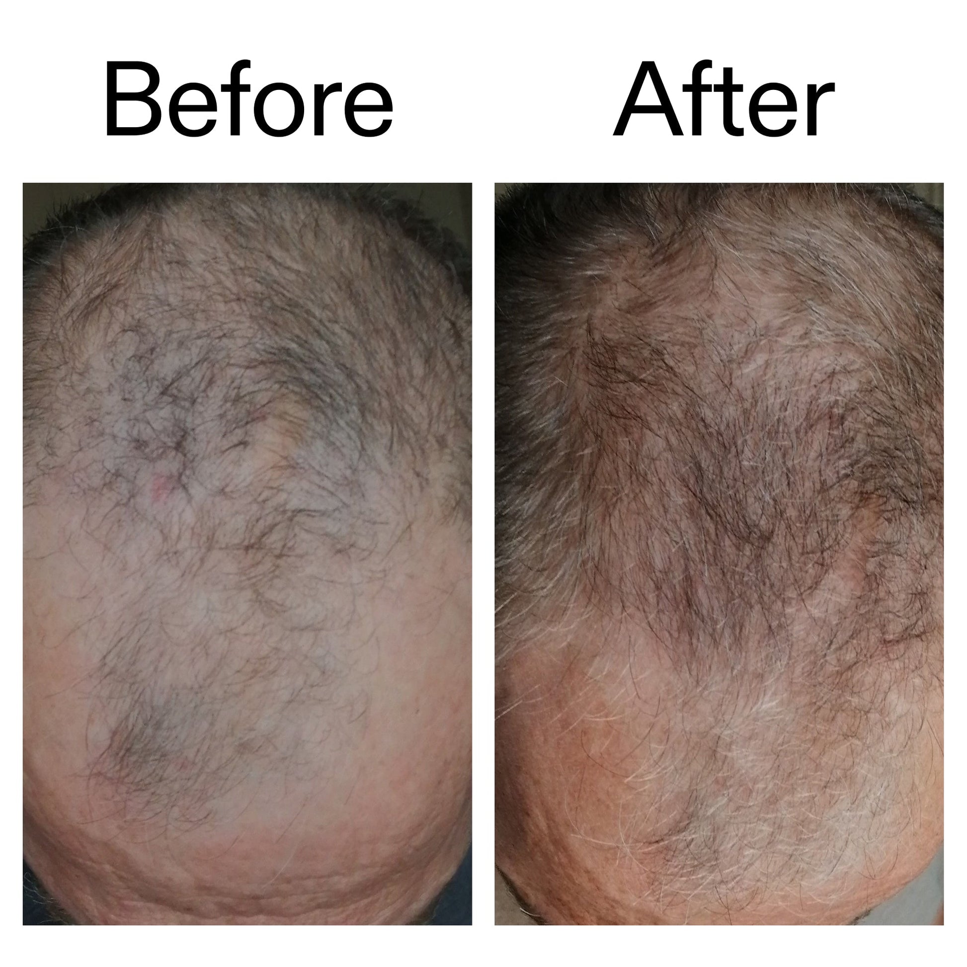 3-month-hair-growth-trio-u2 Caffeine_Scalp_Treatment_B_A_Ppage_2000_x_2000.jpg