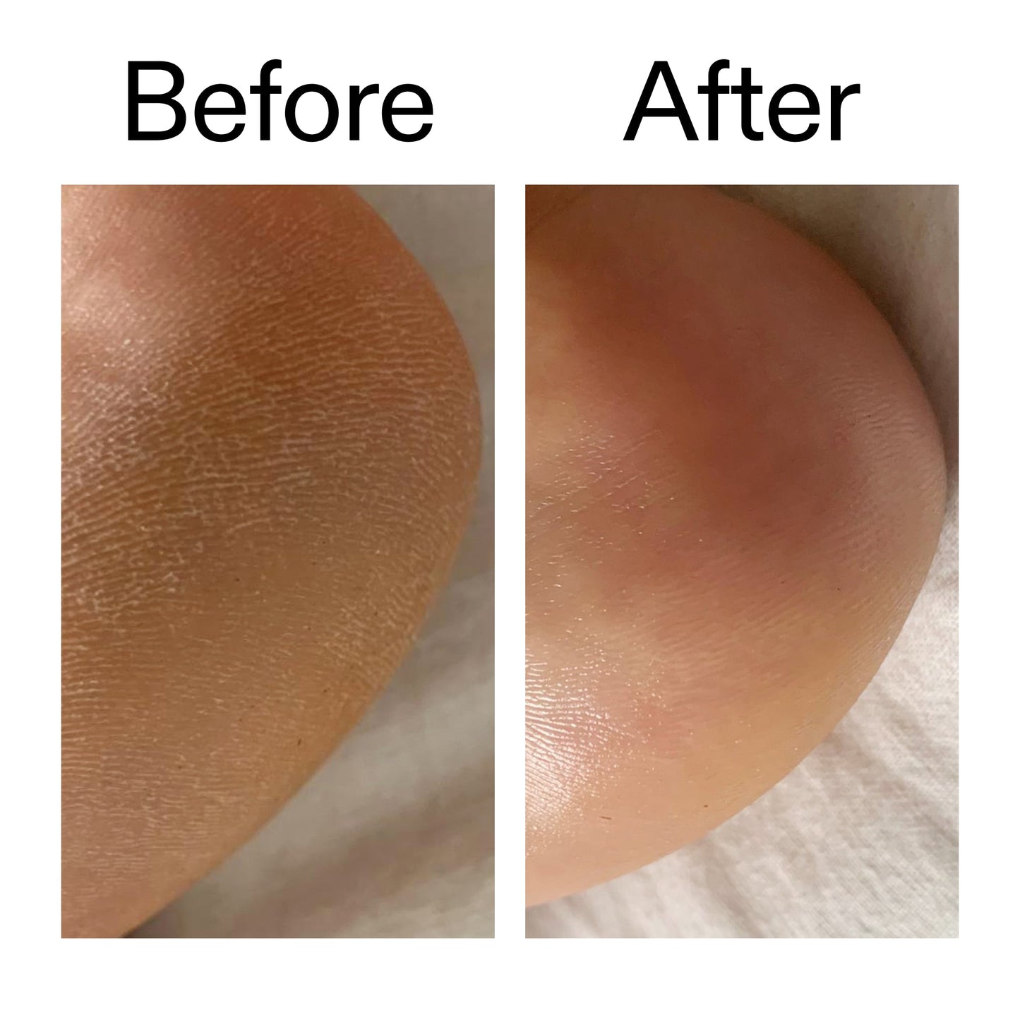 glycolic-acid-exfoliating-body-stick-k4 Glycolic_Acid_Exfoliating_Body_Stick_Before_After_V1_2000x2000_a3043625-9400-429a-a7fb-d6dbd220f722.jpg