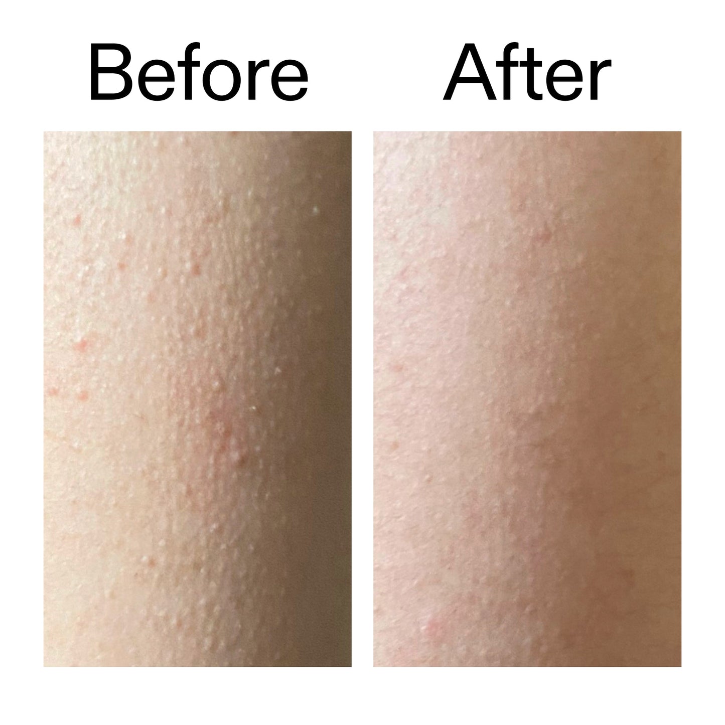 glycolic-acid-exfoliating-body-stick-k4 Glycolic_Acid_Exfoliating_Body_Stick_Before_After_V2_2000x2000_2e4ba052-94f6-4d56-82df-7bdb5b2df7ae.jpg