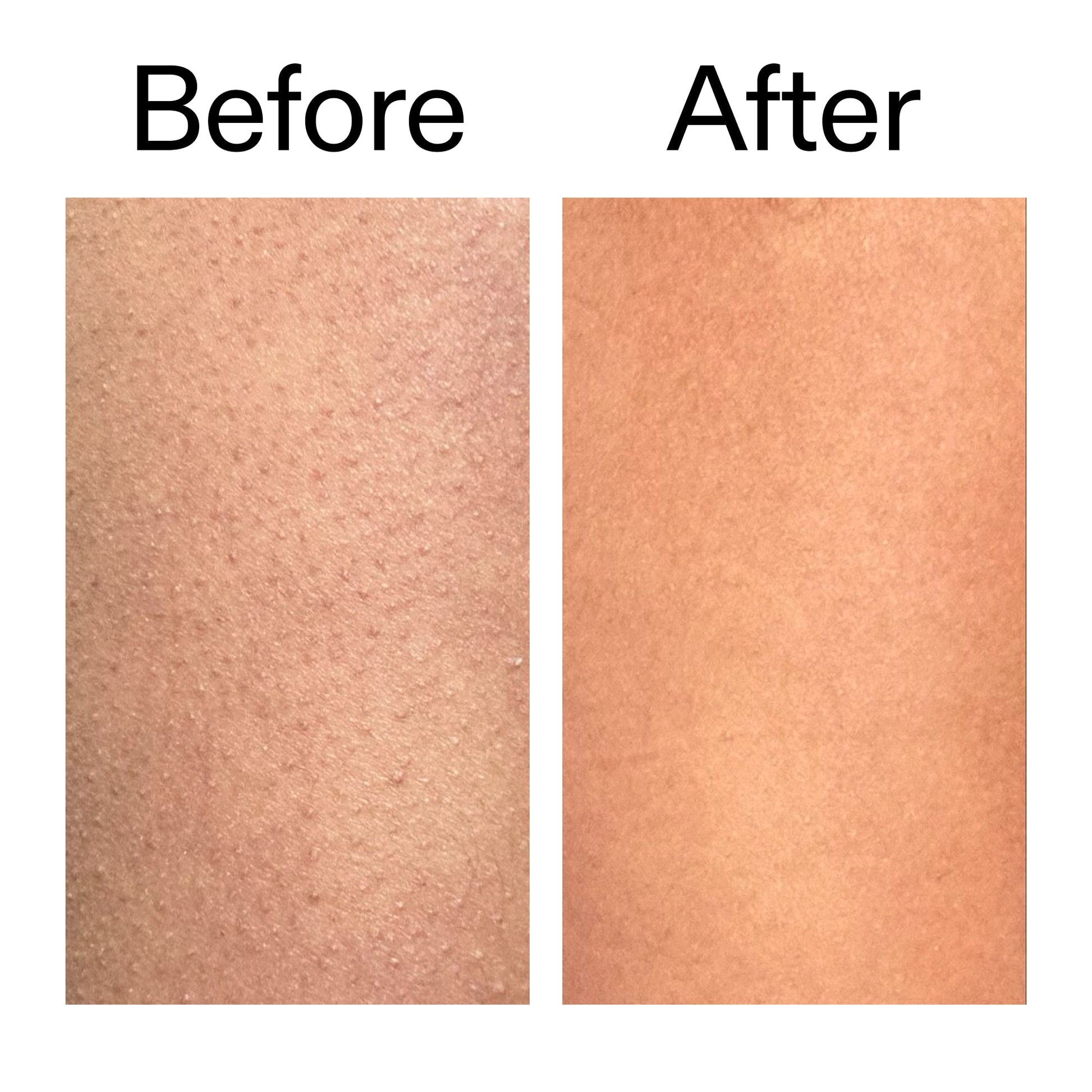 glycolic-acid-exfoliating-body-stick-k4 Glycolic_Body_Stick_B_A_2000x2000_6e6e6b4d-5bd7-43c0-aeed-4d66788e8995.jpg