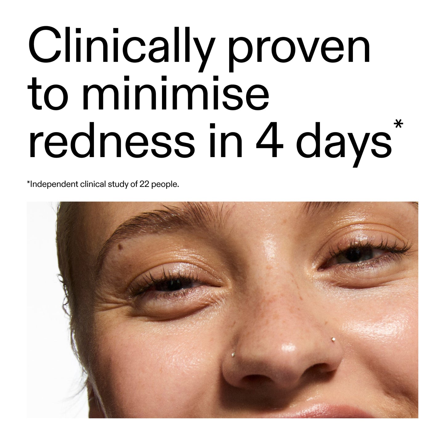 10-azelaic-acid-serum-for-redness-relief-e5 Oat_Cleansing_Balm_Claim_2000x2000_52a841dc-353c-4f2c-8646-3aadb604507d.jpg