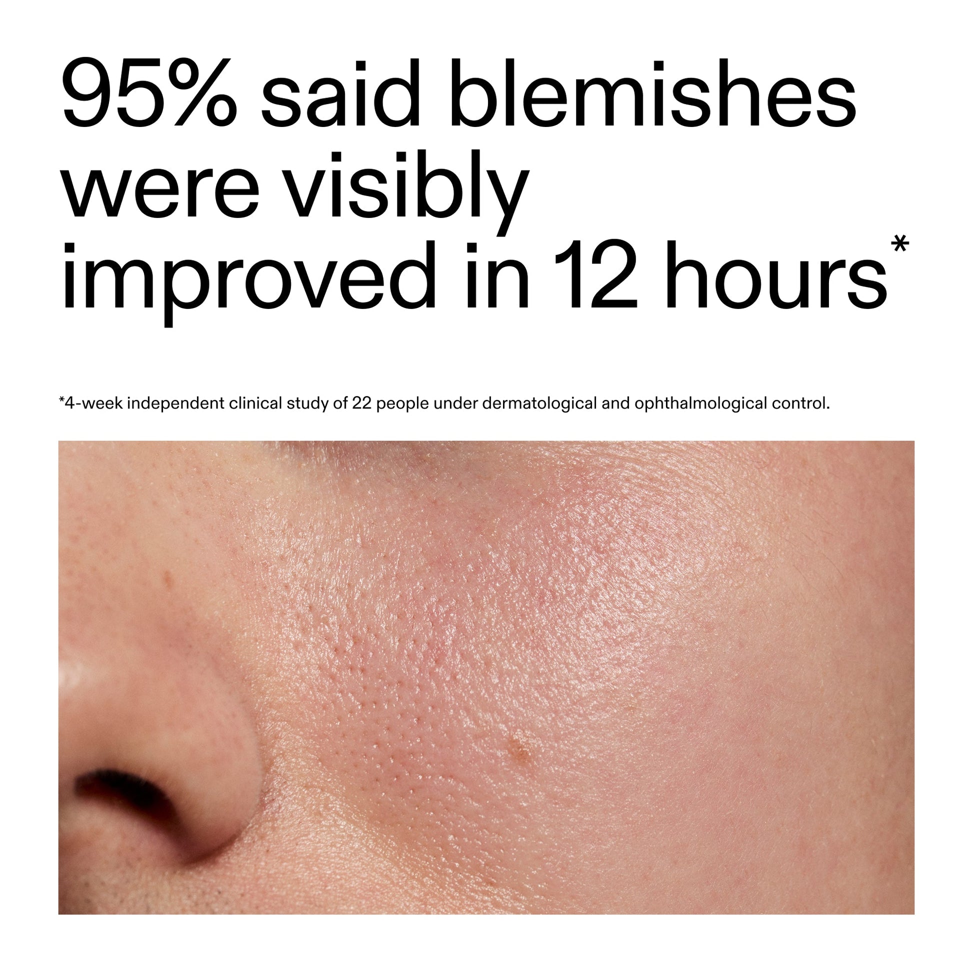 succinic-acid-acne-treatment-y1 Oat_Cleansing_Balm_Claim_2000x2000_ac6ce553-25db-41b2-a981-faae1ac4b8c0.jpg