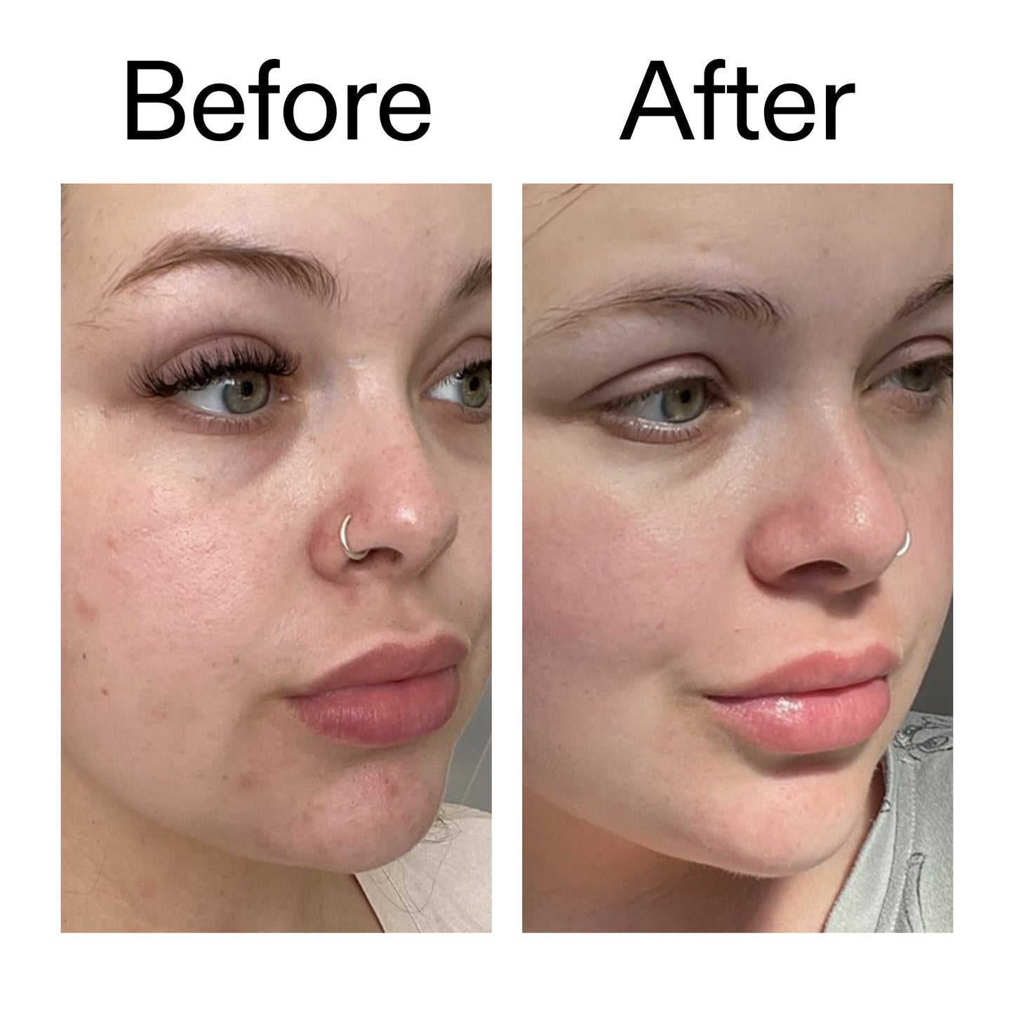 omega-water-cream-50ml-s9 Omega50_Before_After_2000x2000_46483ed8-3f9d-487f-9a0c-9df79830bd65.jpg