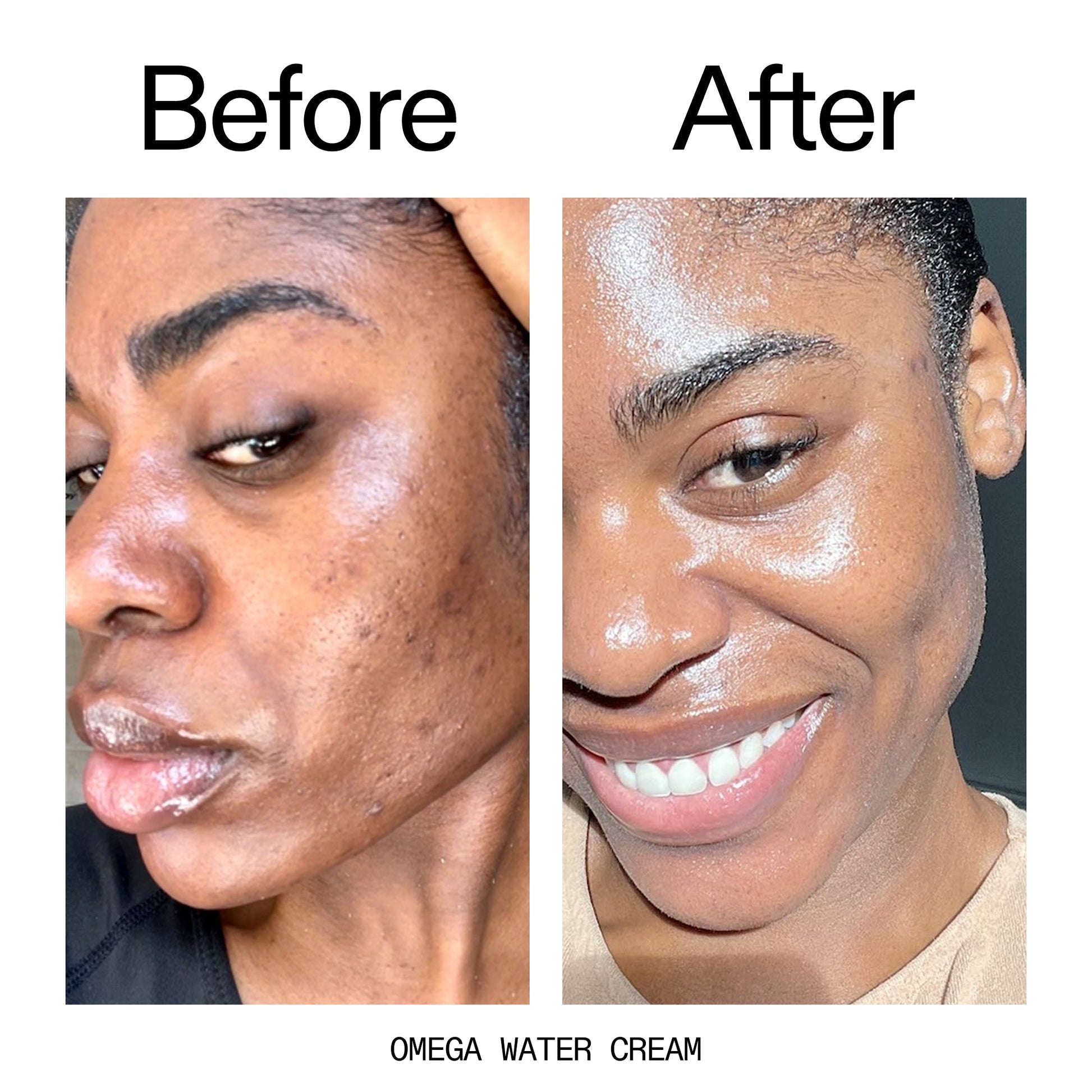 hydrating-cleanser-and-moisturizer-duo-t4 Omega_Water_Cream_Before_After_2000x2000_8e88278b-8c8d-48dc-ac77-4e98ebbd1b77.jpg