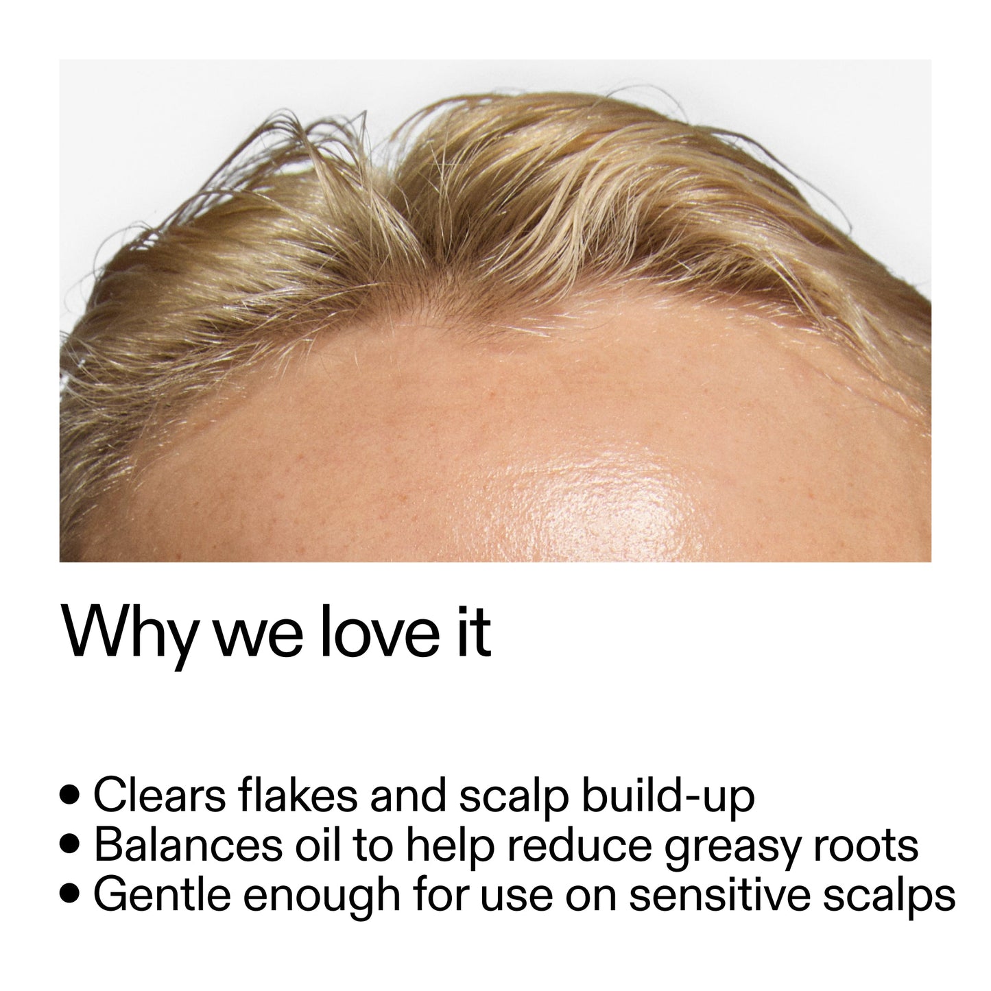 salicylic-acid-exfoliating-scalp-treatment-k1 Salicylic_Acid_Exfoliating_Scalp_Treatment_Why_we_love_it_2000x2000_44b6bd6d-9ec4-4b23-9dc4-bc3fd6f28e14.jpg