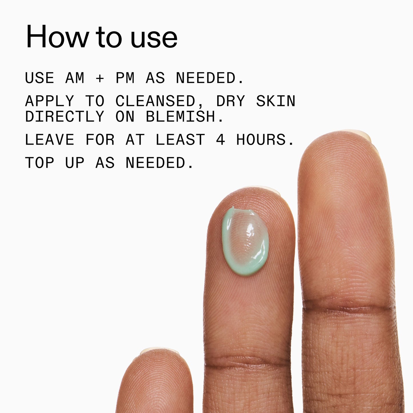 succinic-acid-acne-treatment-y1 Succinic_Acid_Treatment_How_to_Use_2000x2000_d57137d5-d7f1-427c-9a46-5fc00c19c542.jpg