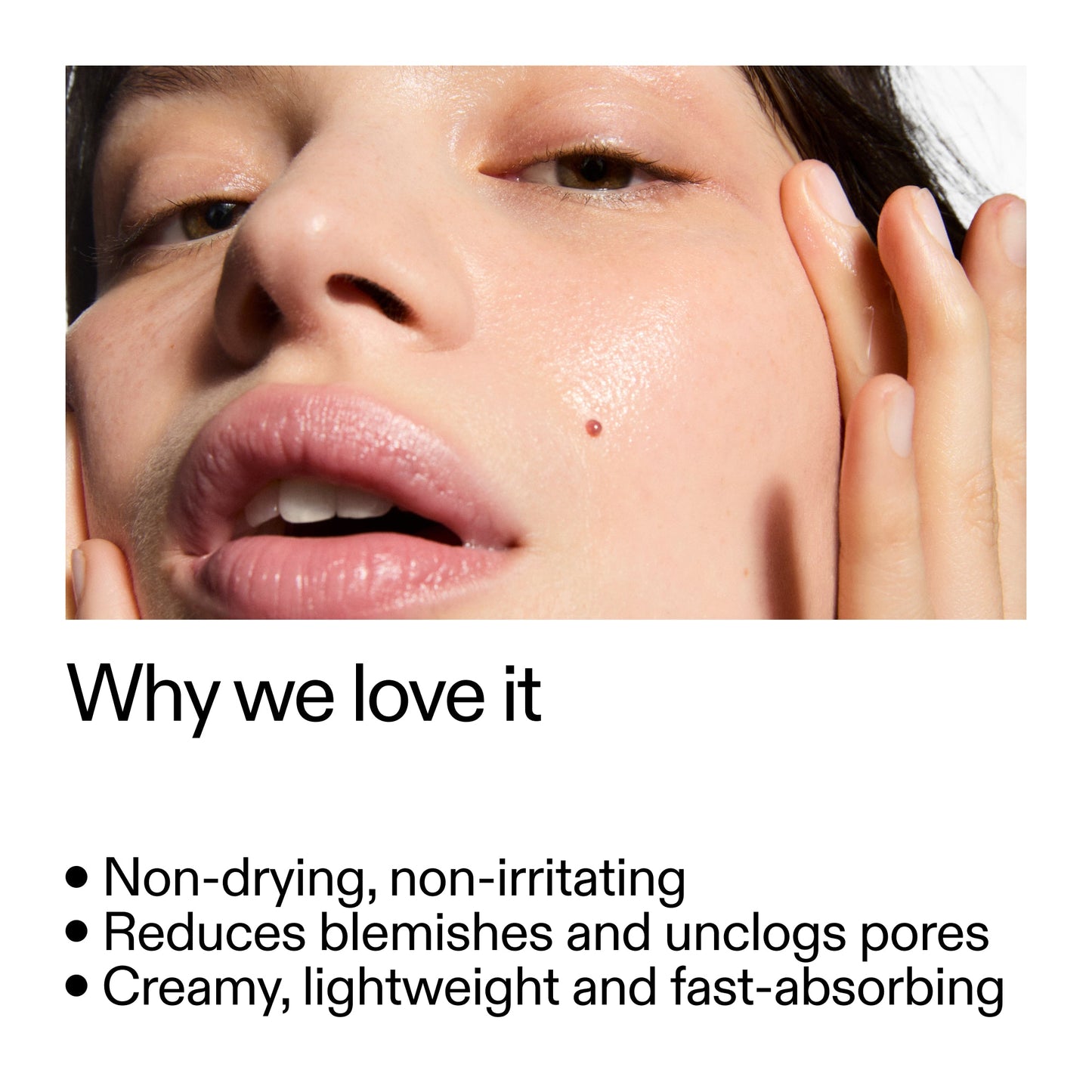 succinic-acid-acne-treatment-y1 Succinic_Acid_Treatment_Why_we_love_it_2000x2000_e90dd42a-cfe9-48b5-a2c7-d5eda787a6a8.jpg