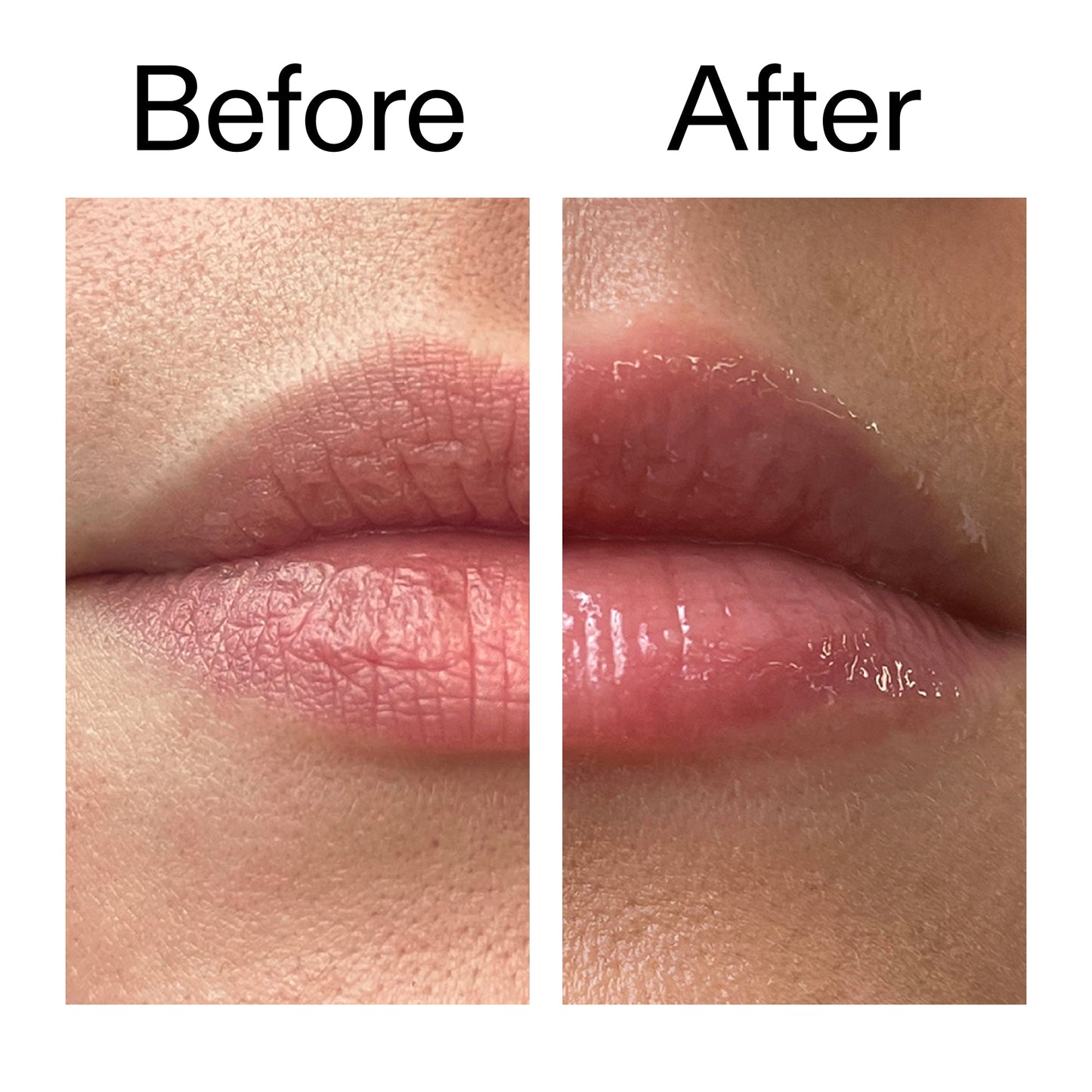 tripeptide-plumping-lip-balm-p7 Tripeptide_Plumping_Lip_Balm_Before_After_2000x2000_b4a5ee04-d2ac-4857-8f01-17209acc4bf3.jpg