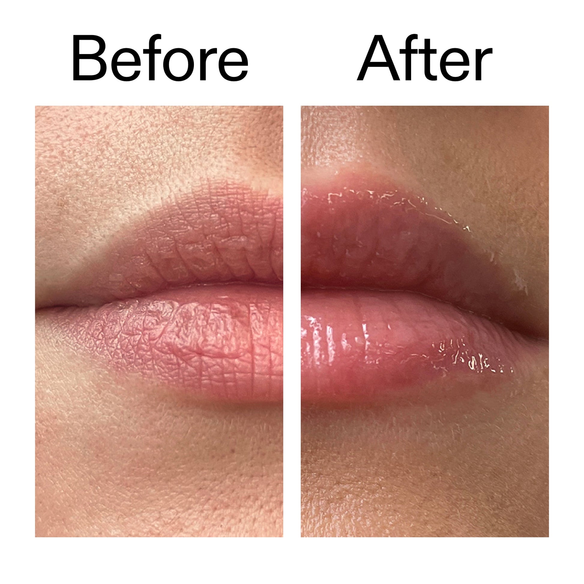 tripeptide-plumping-lip-balm-p7 Tripeptide_Plumping_Lip_Balm_Before_After_2000x2000_b4a5ee04-d2ac-4857-8f01-17209acc4bf3.jpg